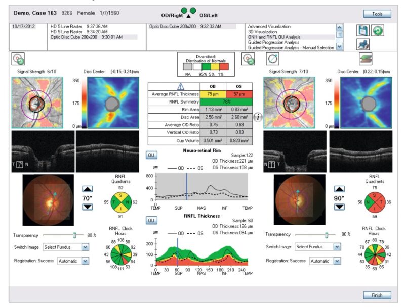 State of the art eye exam equipment for Comprehensive Eye Examination